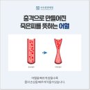 미르카센타 이미지