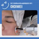 대구 피부관리 모공탄력 고민 아미뷰티 타이트닝X 시술 후기