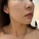 소사에스테틱 윤곽관리 리프팅관리 수기관리 뷰티새로움 솔직후기