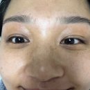 떡볶이낭자&오뎅낭군 | 살까 말까할 땐 사지말고 할까말까할 땐 하라고 했는데, 그렇다면 피부관리 재결제를 해야할까 말까...