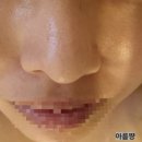 장안로52번길 | 분당피부관리 고원장의모공세척테라피 분당점 수분잠금 리프팅 대만족 후기