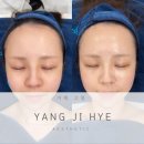 거제피부관리 찾는다면? 거제 양지혜 에스테틱 슈퍼젝션 블랙 직접 받아본 후기