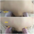 채연 | 부산 서면 바디관리 채연바디혁명 미채뷰티 방문 후기 🌡