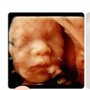 D-25 | 25주차 산부인과 검진 후기｜빈혈·비타민D·임당검사 + 입체초음파 기록