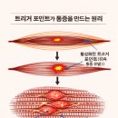 도수 저항 기법(MRT)이란? 근육을 ‘힘으로 푸는’ 가장 똑똑한 치료법 이미지