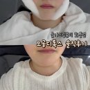 울산북구화봉동피부관리 올가드림뷰티 화봉점 모공디톡스 솔직후기