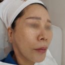 미더베스트 부천점 | 부천피부관리 미더베스트에서 수분 미백 케어