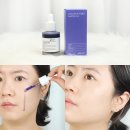 여드름성 피부 앰플 추천! 글로우엠 아줄렌 PDRN 앰플 피부장벽강화도 가능