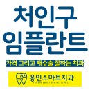 엄지치과기공소 | 처인구임플란트 가격 그리고 재수술 잘하는 치과