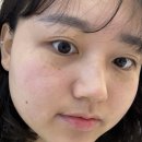 세븐일레븐 중부대로점 | [올가드림뷰티 삼가점] 재방문의사O, 모공청소관리 후기 before/after, 피지(모낭충)상태 확인 / 용인...