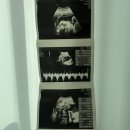 러브미의원 | [광주 러브미여성의원] 진월동 산부인과ㅣ임산부 임신 24주 자궁초음파 사진·동영상 후기