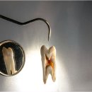 서울밝은미소치과의원 | 예쁜미소를 위한 채소 매일 실천할 수 있을까요