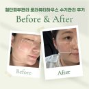 첨단산업8로 | 첨단에스테틱 수분피부관리 추천 광주 로라뷰티하우스 수기관리 후기