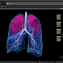 IB 소프트 이미지