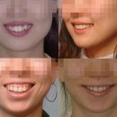 연세윤앤민치과의원 네이버블로그