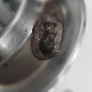 <담석증> 담낭제거수술 당일 후기