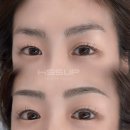 아이솔루션눈썹