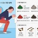 초록새 대변 걱정된다고요 이미지