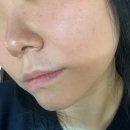 기계식주차장(올림픽공원역 3번) | 쥬베룩스킨 튠페이스 효과 좋았던 강남 신논현 피부과 후기