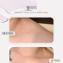 목포승모근마사지후기/벨라미에서 데콜테 관리 받고왔어요
