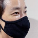 루아크짐 | 눈밑지 후기 (눈밑지 성지 루아크 성형외과)