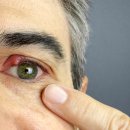 경산제일안과 이미지