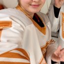 서면롯데백화점피부과 수입산 입술필러 전후 차이 가로확장 자연스러운게 대세