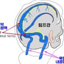 뒷골이 땡기는 이유 5가지와 땡길때 대처 방법 : 왼쪽 오른쪽 뒤통수(머리 뒤쪽) 통증 땡김 두통 찌릿 이미지