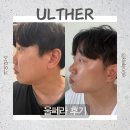 커피빈압구정로데오 | 압구정피부과 울쎄라 , 이중턱라인 고민으로 받아본 내돈내산 후기