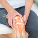 무릎 건강 지키는 생활습관, 바로바로 효과 보는 무릎 찜질법 이미지