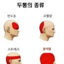 두통에 종류...보기만해도 머리 아프네요 이미지