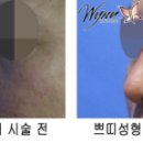 윈클리닉, 여자만? Oh∼NO!! 남자도 한다!! -쁘띠성형-.......... 스타 영어강사 양성과정 www.tesol.tv 이미지