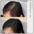 마음에 점을 찍다 | 광주두피문신 고민 끝! 맞춤 상담부터 자연스러운 변화까지 만족했던 마음에 점을 찍다 광주본점 후기