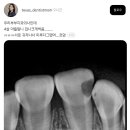 치과의사 부부 아이의 치아 상태. 이미지