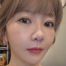 써니와이 | 신사역피부과에서 써니리프팅 받아본 찐 후기(통증,가격)