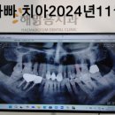 해맑음치과 네이버블로그