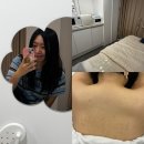 구로 모찌살롱 디멜라필로 여름철 등 관리 구디피부관리 솔직 후기!