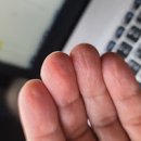 손끝 갈라짐과 벗겨짐의 원인 및 해결 방법 : 손가락 끝 이미지