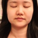은혜체형관리 - 계양구 까치말로 16 | 천안피부관리 신부동 윤곽관리 헤리티지 턱선관리 은혜님 실 후기