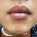 혁신뷰티의원 이미지