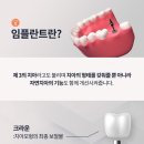 오플란트치과의원 이미지