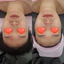 구암동306 | [대구구암동피부관리/대구북구피부관리실] &#39;더빛나스킨케어&#39;에서 울트라v리프팅 받은 후기!