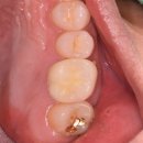 애플치과기공소 이미지