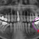 송탄바른치과의원 이미지