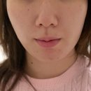 힐링셀플렉스 | 선에스테스파 마곡점 | 퍼스널 윤곽 관리 솔직 후기! 합리적인 경락가격으로 역대급 경락효과 본 예신...