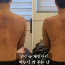 피부에밥주는날