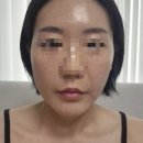 고운동_고운동(마음로) | [리프레시 뷰티인재양성교육센터]세종시 고운동 미백, 탄력관리 후기, 세종시 피부관리 추천