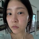 평택 하나뷰티 콜드플라즈마 풀페이스 내돈내산 후기 🩵💭