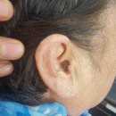 스타키보청기안산단원센터 이미지