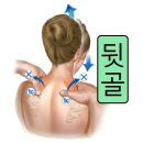 뒷골 이미지